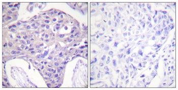 FoxO1/3/4 rabbit pAb Antibody