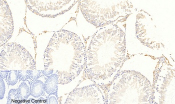 FoxO3A (phospho Ser253) rabbit pAb