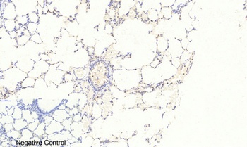 FoxO3A (phospho-Ser253) antibody