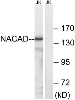 NACAD antibody