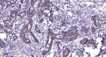 NACAD antibody