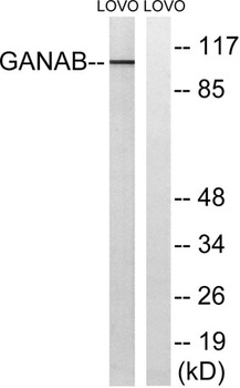 Glucosidase IIalpha antibody