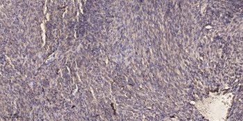 Glucosidase IIα rabbit pAb