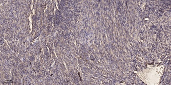 Glucosidase IIalpha antibody