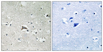 Flt-1 antibody