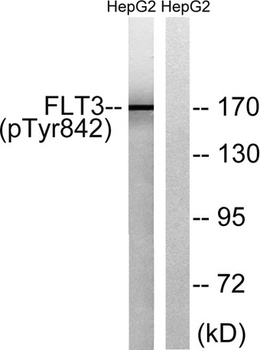 Flt-3 (phospho Tyr842) rabbit pAb