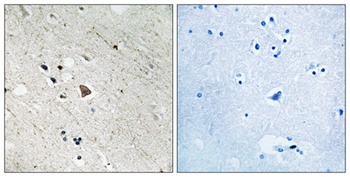 Flt-3 (phospho Tyr969) rabbit pAb
