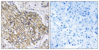 Latrophilin-2 rabbit pAb