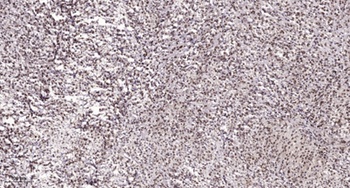 CstF-64T rabbit pAb