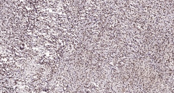 CstF-64T antibody