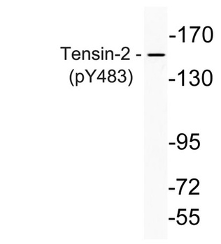 Tensin-2 (phospho-Tyr483) antibody