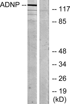 ADNP antibody