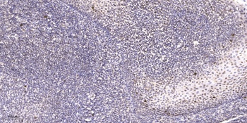 HRT2 antibody