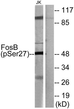 Fos B (phospho-Ser27) antibody