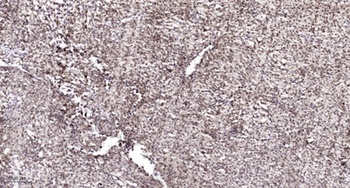 Fos B (phospho-Ser27) antibody