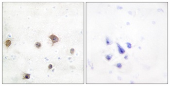 JIP-2 antibody