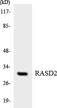 Dexras2 rabbit pAb Antibody