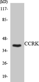 CCRK antibody