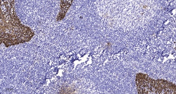 Encephalopsin antibody