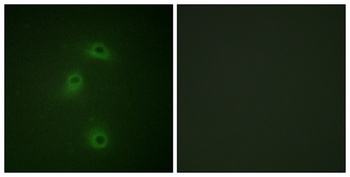 DAPK2 (phospho Ser318) rabbit pAb