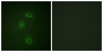 DAPK2 (phospho-Ser318) antibody