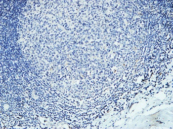 DAPK2 antibody