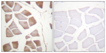 DAPK2 antibody