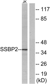 SSBP2 rabbit pAb