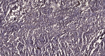 ZKSCAN5 rabbit pAb