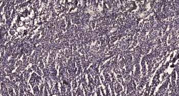 ZKSCAN5 antibody