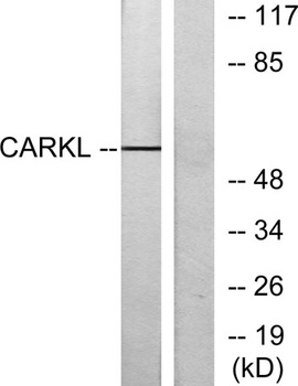 CARKL antibody