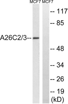POTE-14/22 antibody