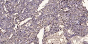 POTE-14/22 antibody