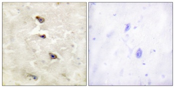 ALK (phospho Tyr1507) rabbit pAb