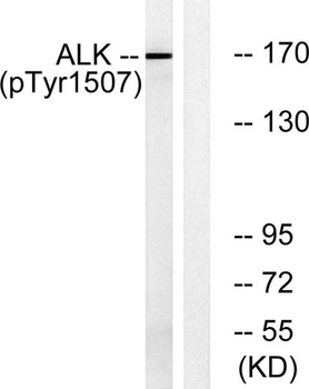 ALK (phospho Tyr1507) rabbit pAb