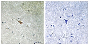 ALK (phospho Tyr1096) rabbit pAb