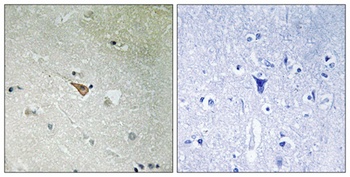 ALK (phospho-Tyr1096) antibody