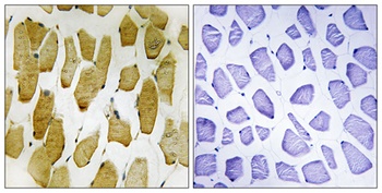 5-LO (phospho-Ser272) antibody