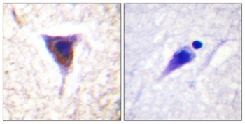 mTOR (phospho Ser2481) rabbit pAb