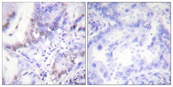 Abl1/2 (phospho Tyr393/439) rabbit pAb