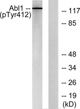 Abl1/2 (phospho-Tyr393/439) antibody