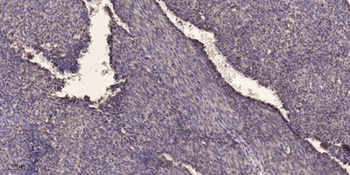 SF-1 antibody