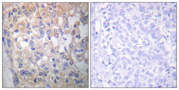 Fyn (phospho Tyr530) rabbit pAb
