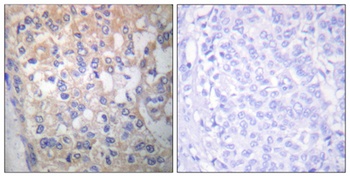 Fyn (phospho-Tyr530) antibody