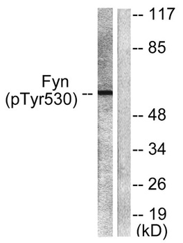 Fyn (phospho Tyr530) rabbit pAb