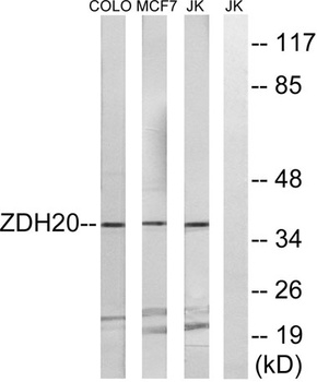 ZDHHC20 rabbit pAb Antibody