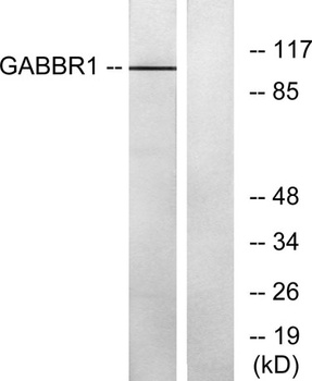 GABAB R1 rabbit pAb