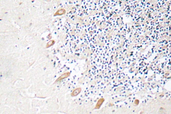 GABAA R beta 2 antibody