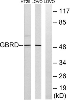 GABAA Rδ rabbit pAb Antibody
