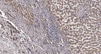 Serpin A11 rabbit pAb